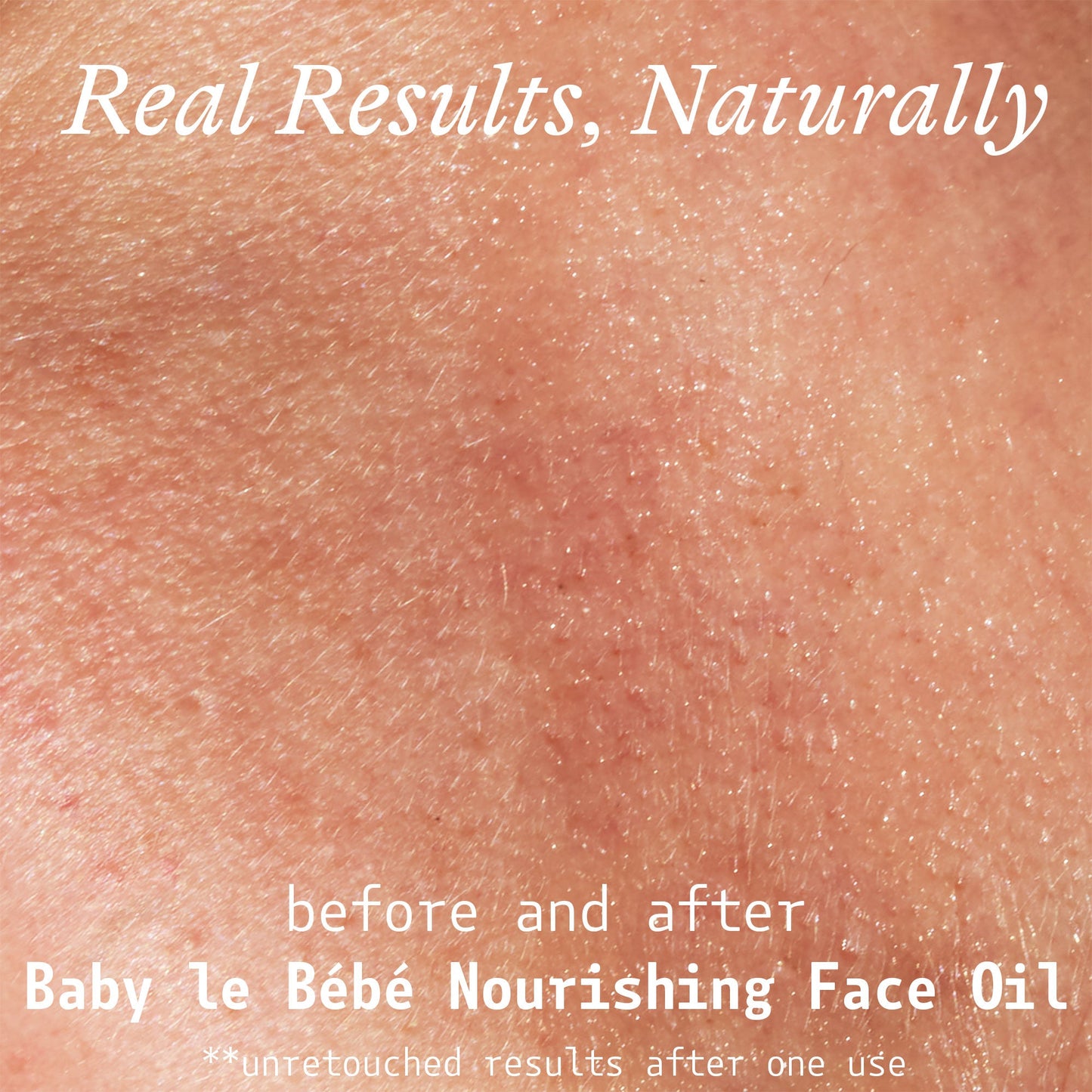 Nourishing Face Oil