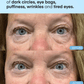 Caffeine & Hyaluronic Acid Eye Gel Patch