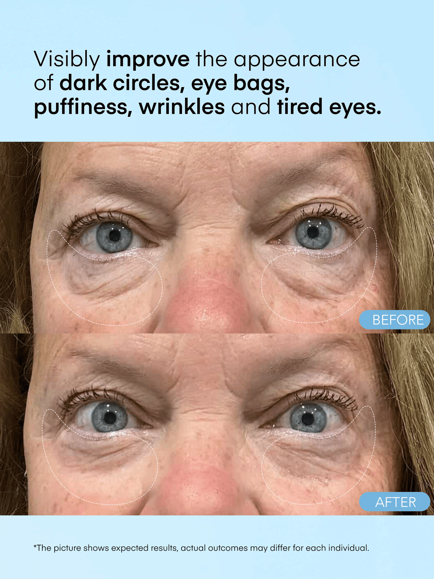 Caffeine & Hyaluronic Acid Eye Gel Patch