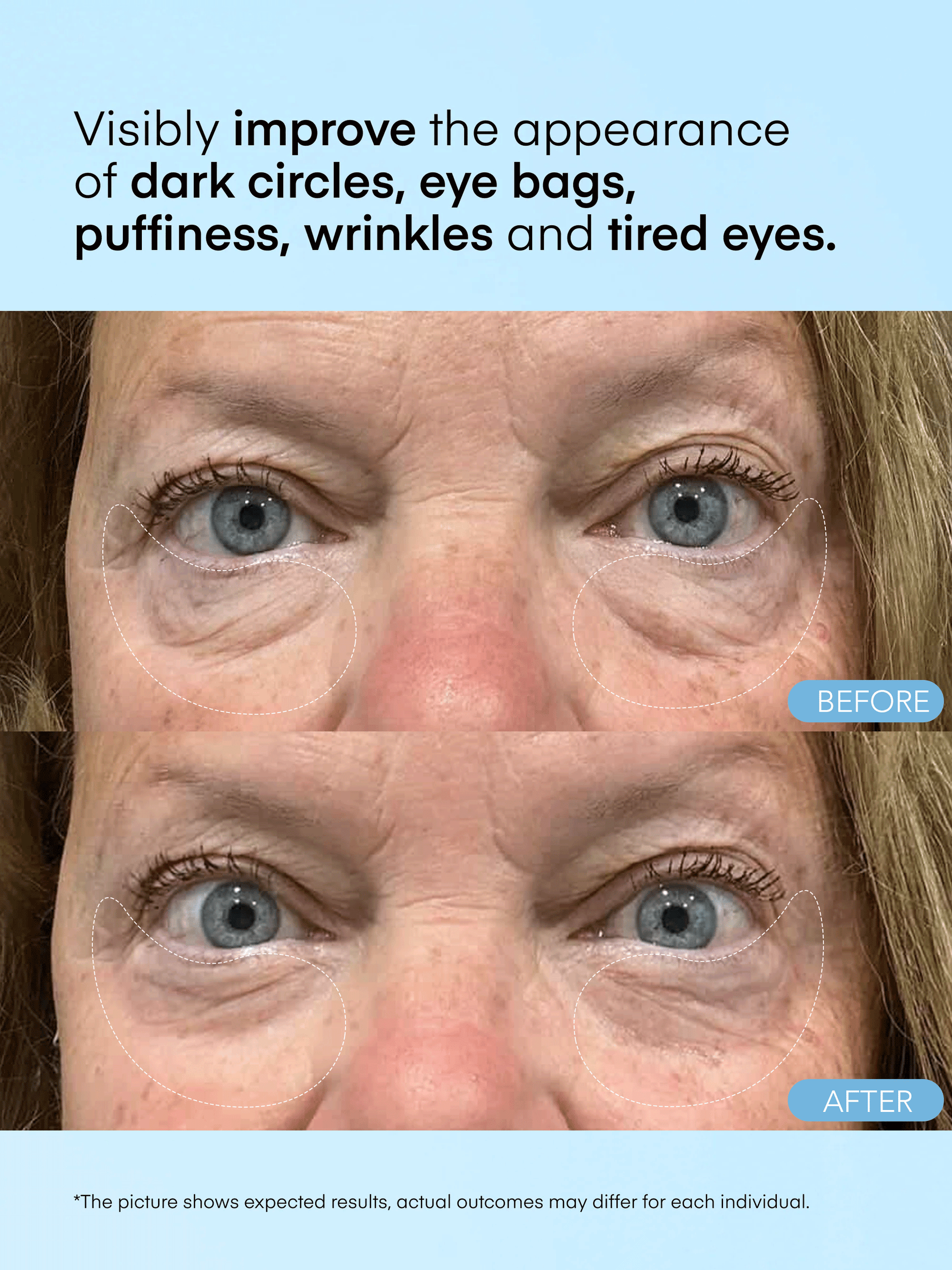 Caffeine & Hyaluronic Acid Eye Gel Patch